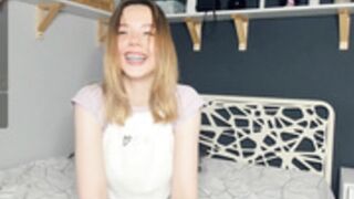 Kesi braces teeth KASSANDRACRUZ, KIRAGAVES, 18 teen