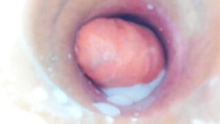 NikkaHOTx Anal Flowers