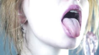 Ginger_hugs, ArteriaOwen, Gingerhugs 0058