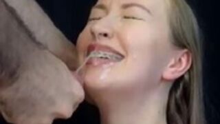 gimbobar huge facial braces first show