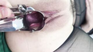asian wife cervix(2)