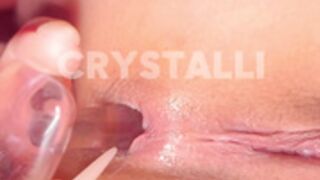 Crystalli 7