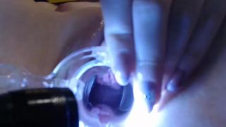 Adinnahot 12-05-2015