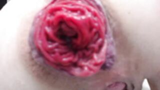 Mika_Passion 2025-08-02 anal prolapse