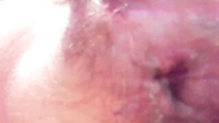 ace_of_devil pussy prolapse/fisting