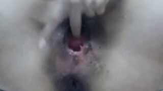 Carolina_Urine Anal fisting and prolapse