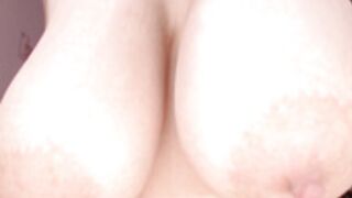 Incrediblyomelia 3 2