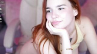 redshinee 5