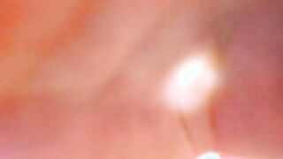 Petitee_Lunna 103