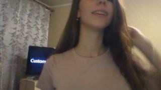 SummersWine braces 10192016