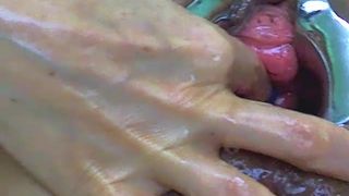 prolapse party raysa.Wx7