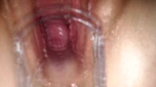 Taboo Hentai Schoolgirl Fucked inside A Gyno Speculum | freckledRED