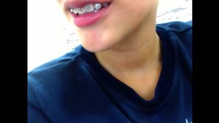 Brackets Cloealec
