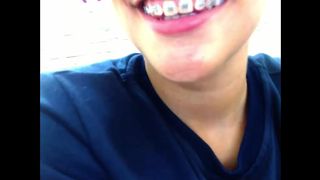 Brackets Cloealec
