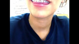 Brackets Cloealec