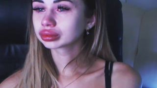 Violla cries in botox