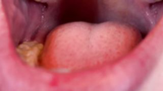 The Roof of Margo Bones's Mouth