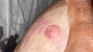 AC lactation