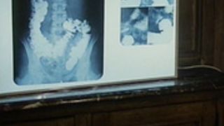 Clinique Des Phantasmes