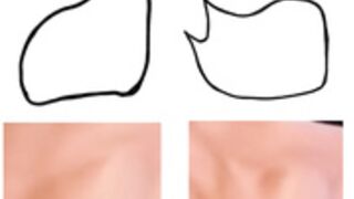 Zuzka ABS anatomy analysis