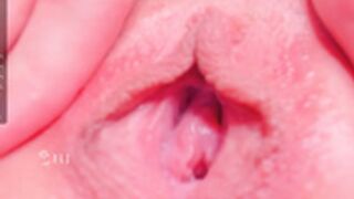 ElsieFoster, rgo_tonsy_2 2022-03-31