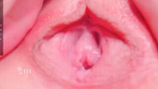 ElsieFoster, rgo_tonsy_2 2022-03-31