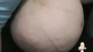 Chelsea Massive Breasts