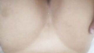 prone bone
