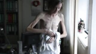 anorexic Sonja
