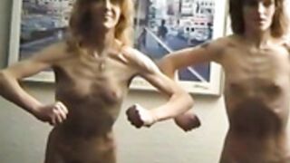 anorexic Tanja & Michaela