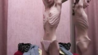 anorexic Janine 6
