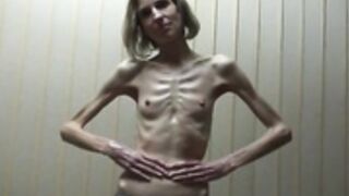 anorexic Sonja 7