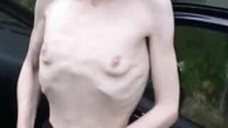 anorexic Romana & Ilka