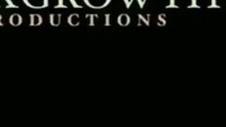 Breast expansion 2 7