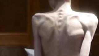 anorexic Christin 7F2xo