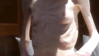 anorexic Christin 7F2xo