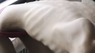 anorexic Nicoleta s9Lc5