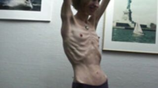 anorexic Sonja 7 2