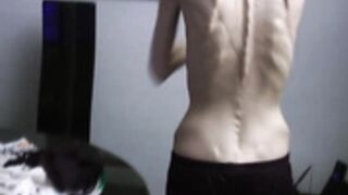 anorexic Denisa p9jK7