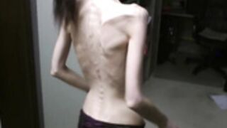 anorexic Denisa p9jK7