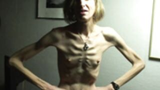 anorexic Sonja 8
