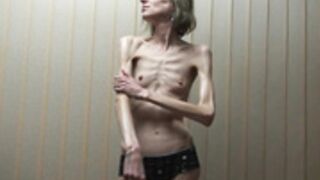 anorexic Sonja 4