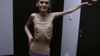 anorexic Denisa x2b6z 2