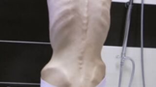 anorexic Denisa x2b6z 2