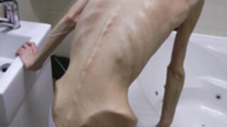 anorexic Denisa x2b6z 2