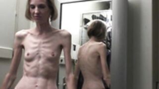 anorexic Sonja 2