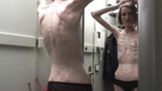 anorexic Sonja 2