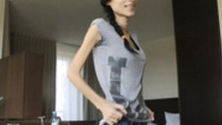 anorexic Nicoleta g3W2c 2