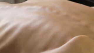 anorexic Nicoleta g3W2c 2