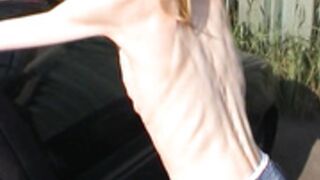 anorexic Suse pose outdoors 8t00408